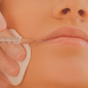 Aumento de labios