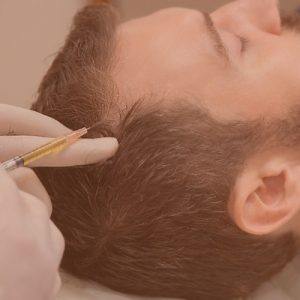 PRP Plasma Rico en Plaquetas