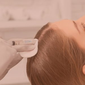Tratamiento capilar con Mesoterapia
