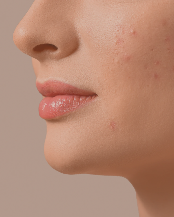 Balance Skin