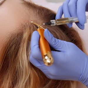 PRP Plasma Rico en Plaquetas