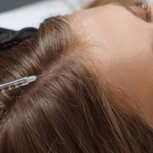 Mesoterapia con Cóctel Bioestimulador